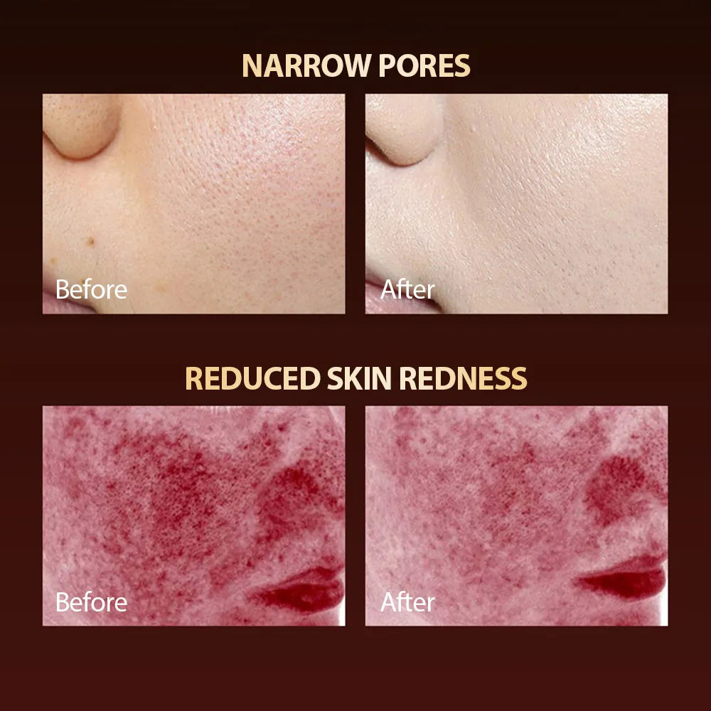 Before and after results of LED face mask showing reduced pores and skin redness.